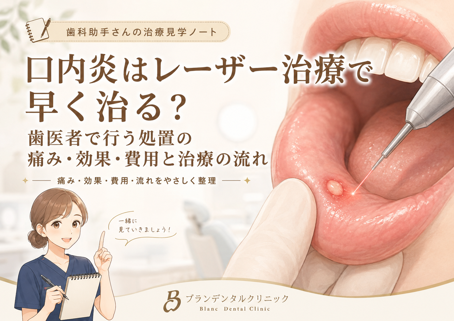 口内炎はレーザー治療で早く治る？歯医者で行う処置の痛み・効果・費用と治療の流れ