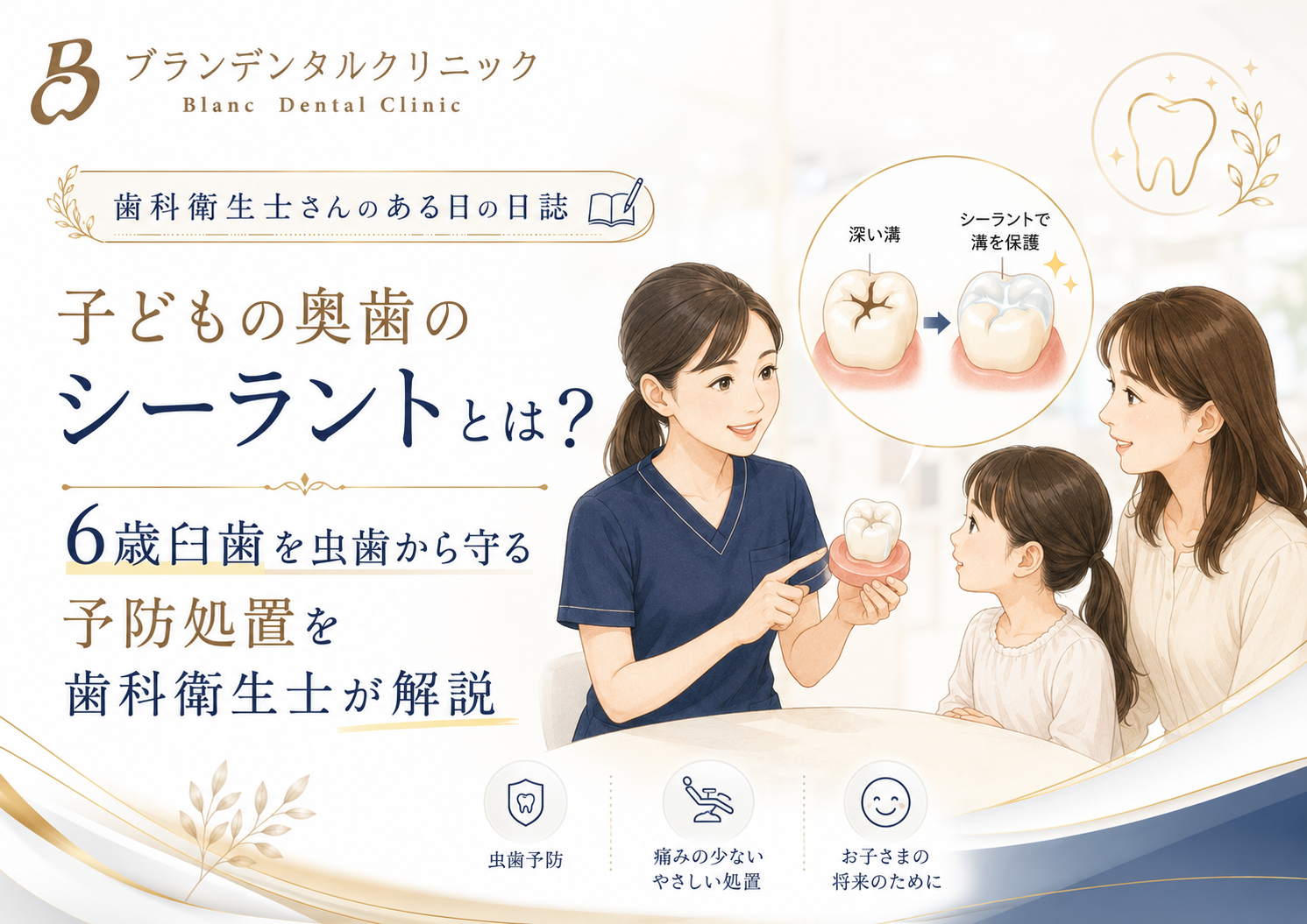 子どもの奥歯のシーラントとは？6歳臼歯を虫歯から守る予防処置を歯科衛生士が解説