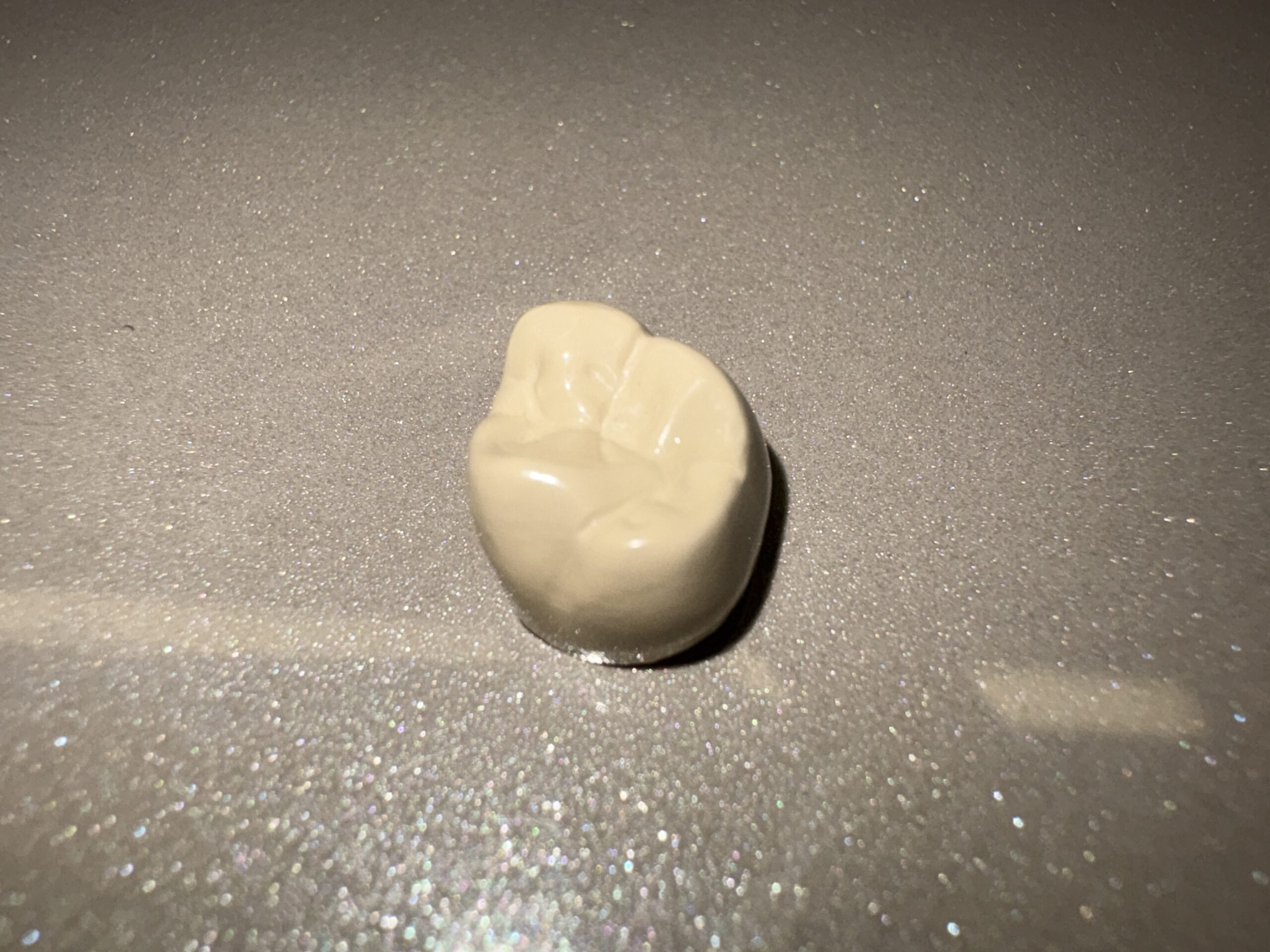 保険で認められているPEEK冠の特徴とジルコニア冠との比較