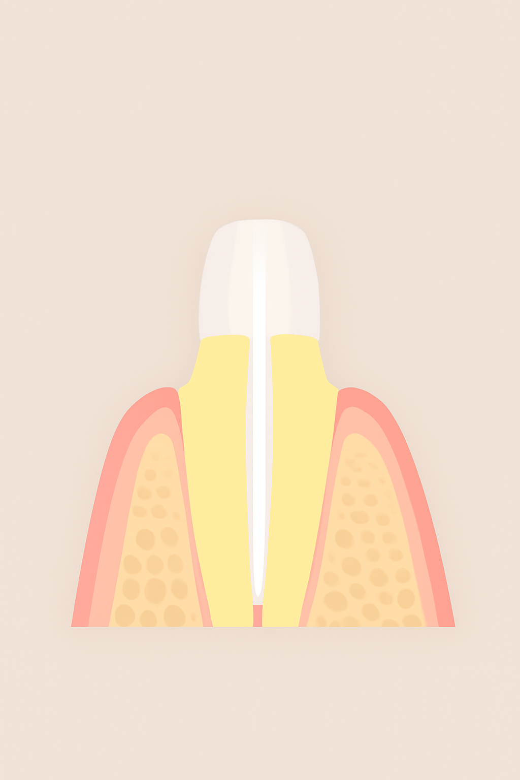 保険適用の歯の土台、メタルコアとファイバーコア:支台築造の比較