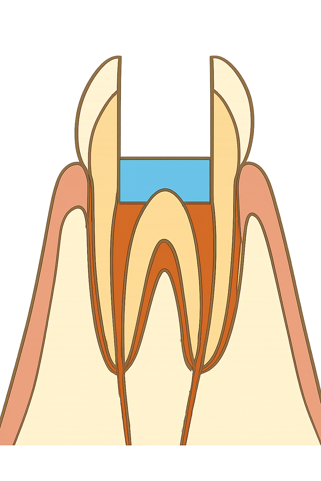 歯の神経を可能な限り救う治療：生活歯髄断髄法を再考察する