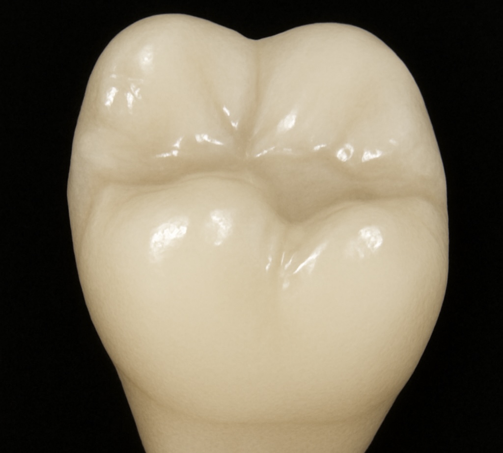 セラミックス(ジルコニア)は対合歯を摩耗させるのか？：硬さと摩耗の関係性