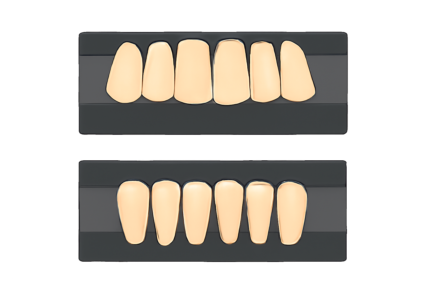 歯科医師、および歯科技工士へのコラム:人工歯脱落の理由は？:硬質レジン歯の特性再考と、技工指示に込める「接着の科学」
