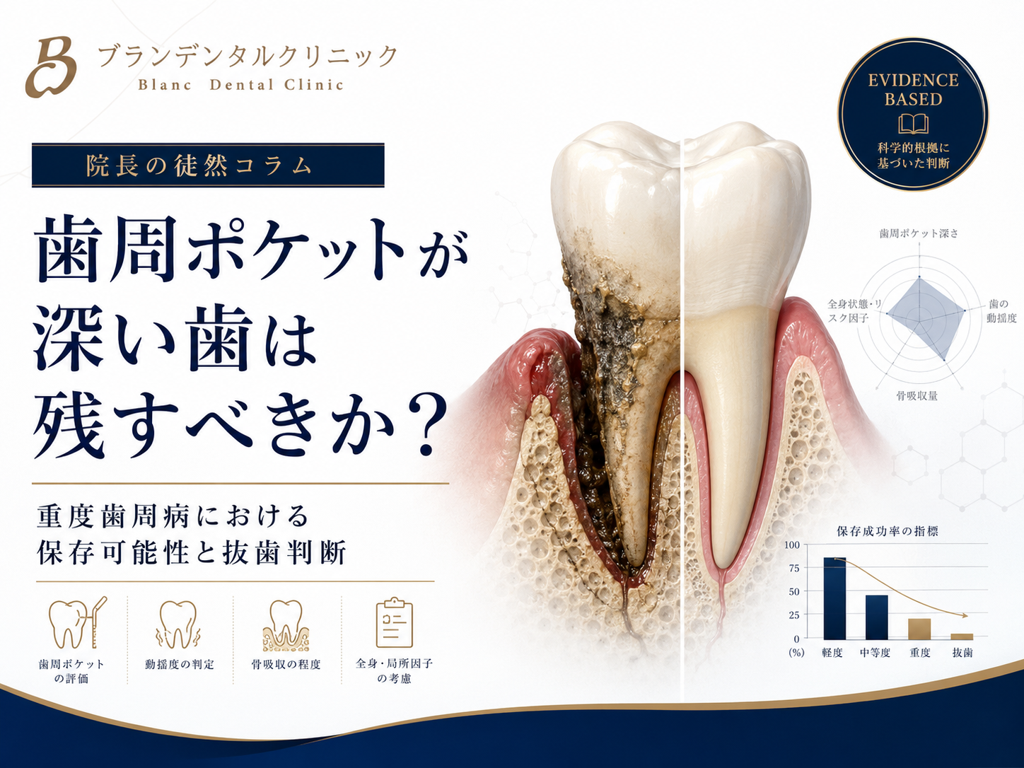 歯周ポケットが深い歯は残すべきか？重度歯周病における保存可能性と抜歯判断