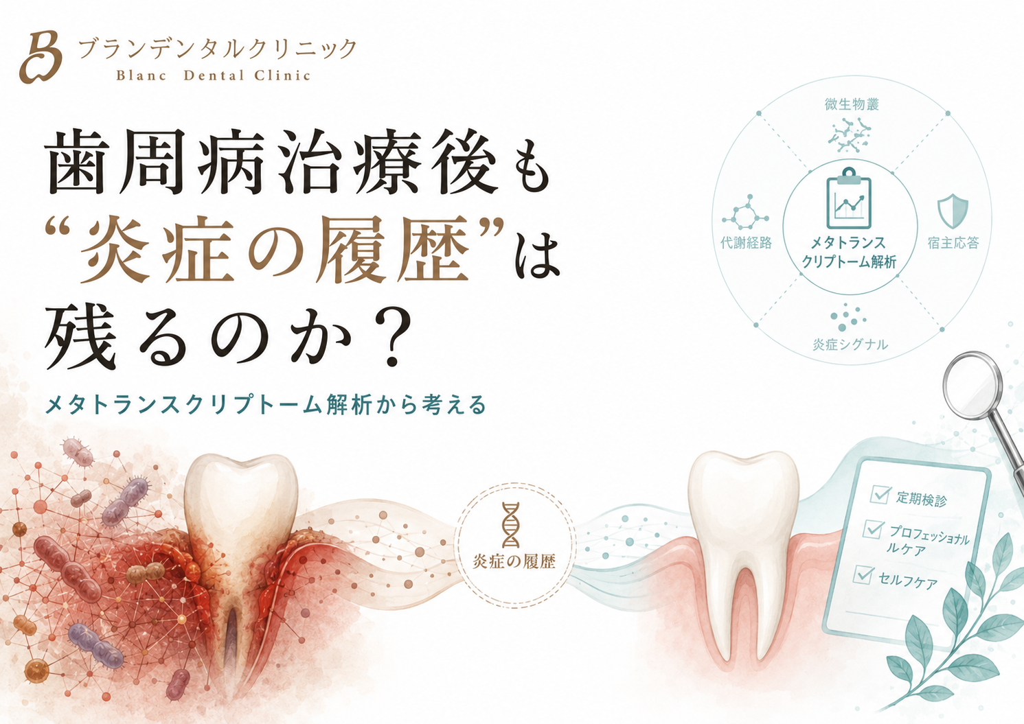 歯周病治療後も炎症の履歴は残るのか?メタトランスクリプトーム解析から考える細菌ネットワーク•宿主応答•メンテナンスの意味