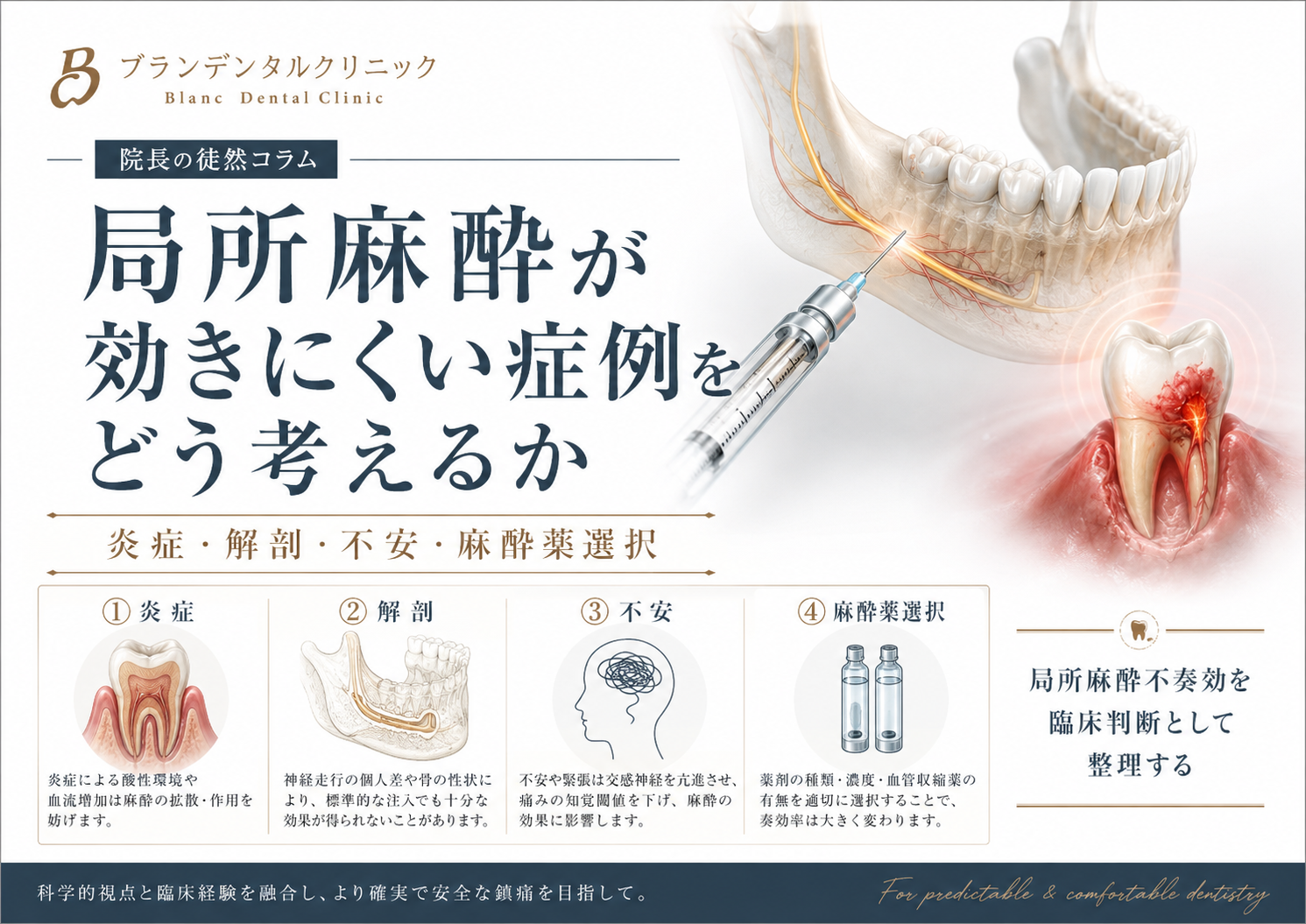局所麻酔が効きにくい症例をどう考えるか：炎症・解剖・不安・麻酔薬選択