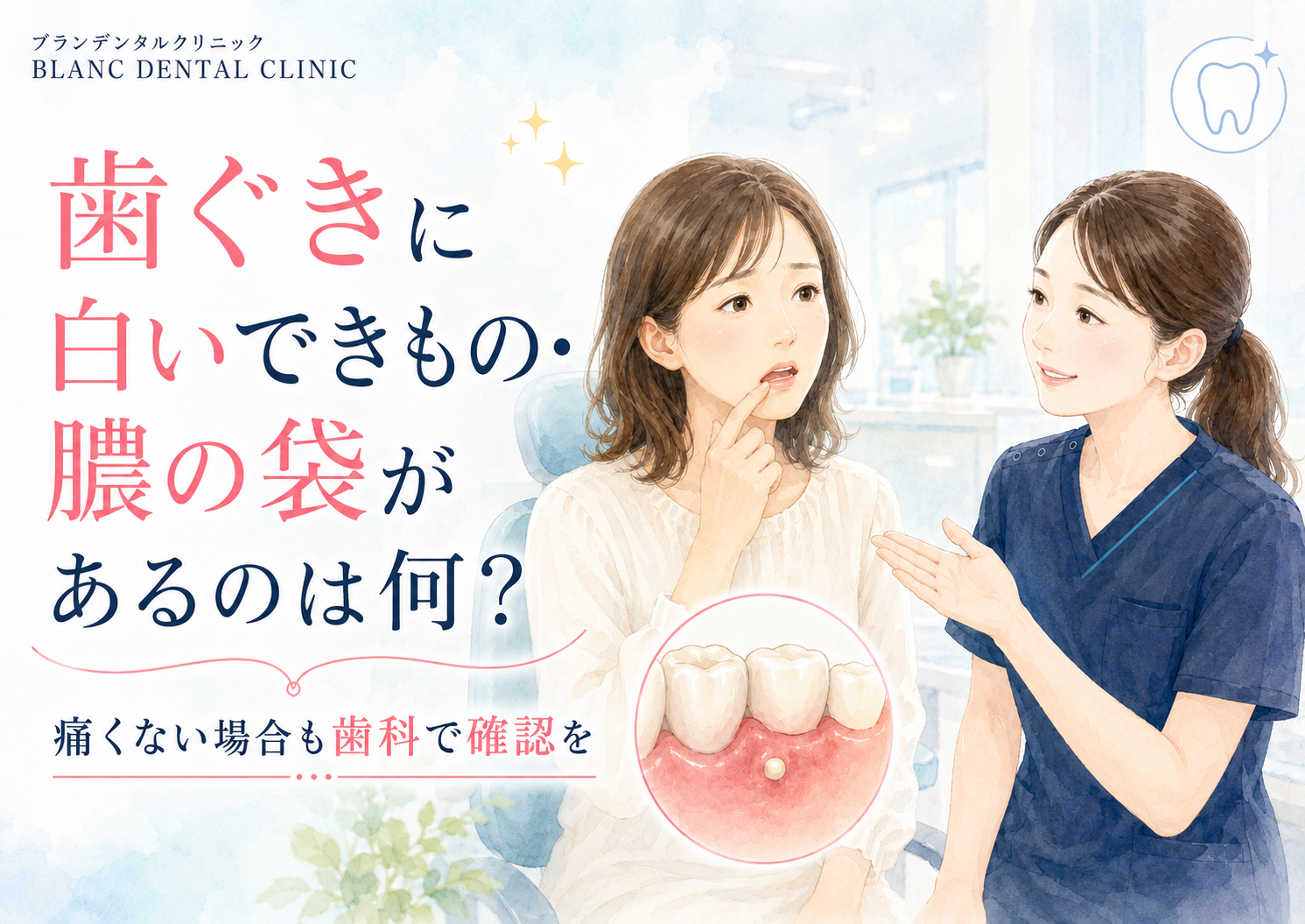 歯ぐきに白いできもの:膿の袋があるのは何？痛くない場合も歯科で確認を