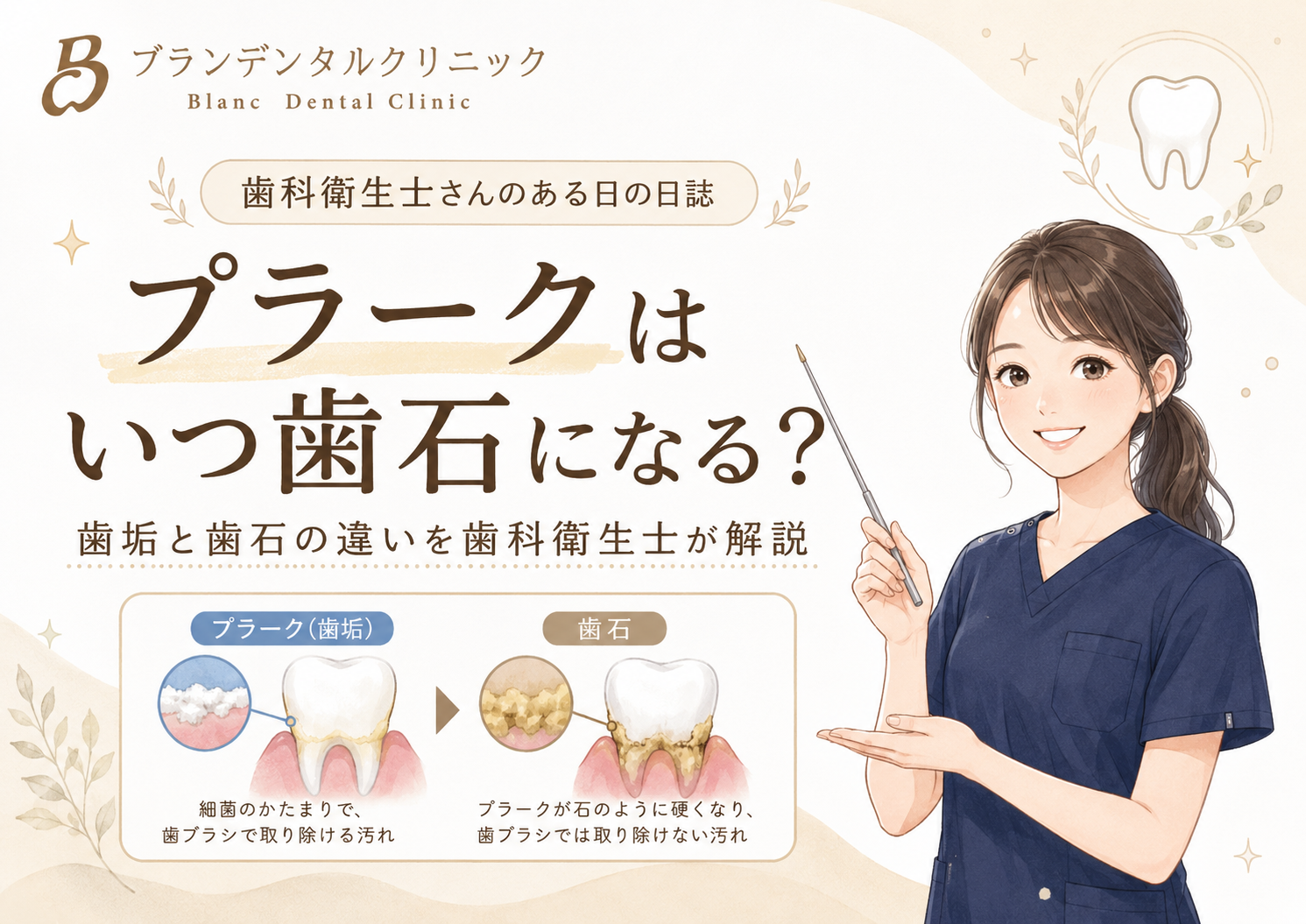 プラークは何日で歯石になる？歯垢と歯石の違いを歯科衛生士が解説
