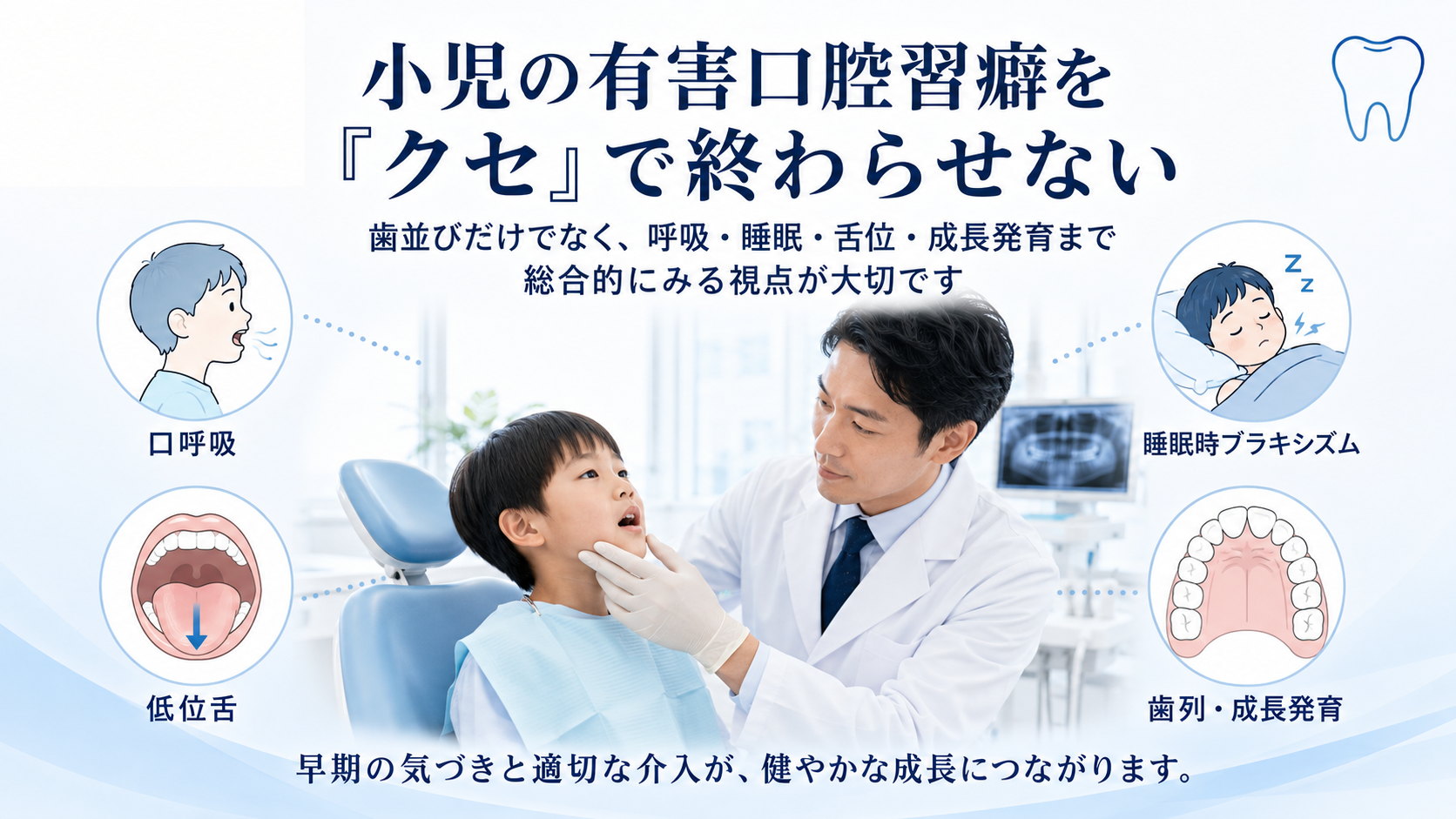 小児の有害口腔習癖を「クセ」で終わらせない:口呼吸・睡眠時ブラキシズム・舌突出癖の歯列・口腔機能・睡眠呼吸の臨床的意味