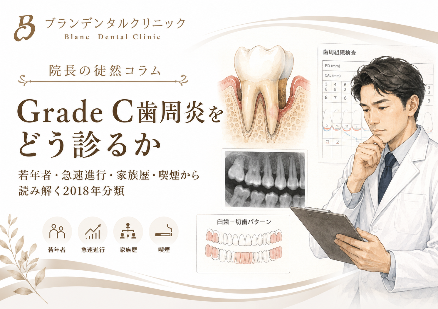 Grade C歯周炎をどう診るか:若年者・急速進行・家族歴・喫煙から読み解く2018年分類