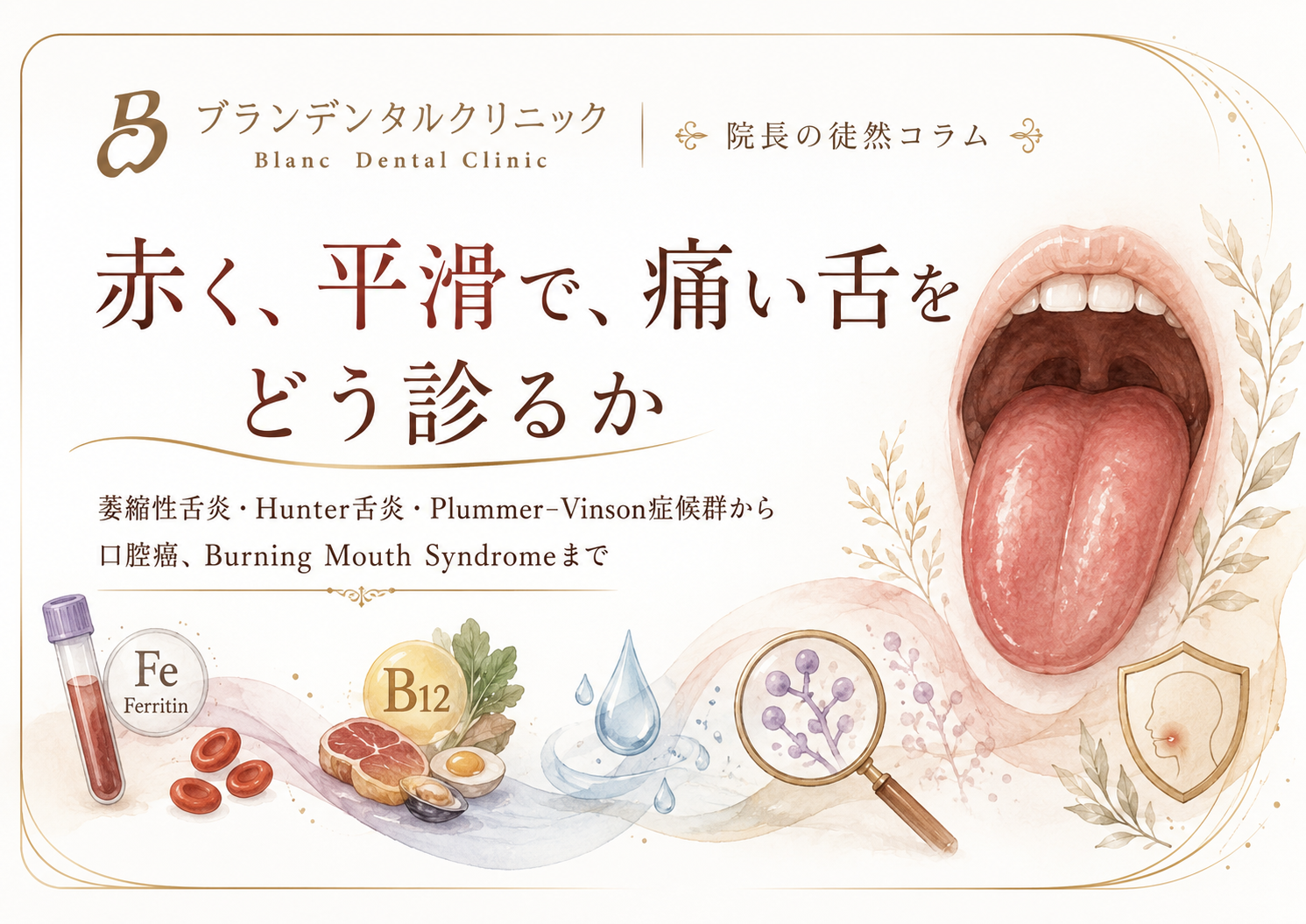 赤く、平滑で、痛い舌をどう診るか？萎縮性舌炎•Hunter舌炎•Plummer-Vinson症候群から口腔癌、Burning Mouth Syndromeまで