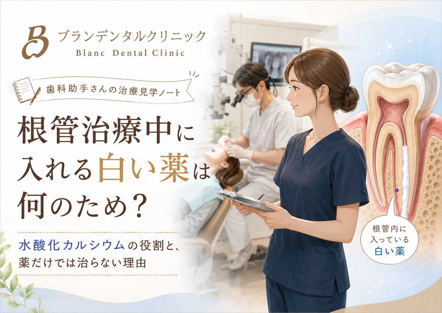 根管治療中に入れる白い薬は何のため？水酸化カルシウムの役割と薬だけでは治らない理由