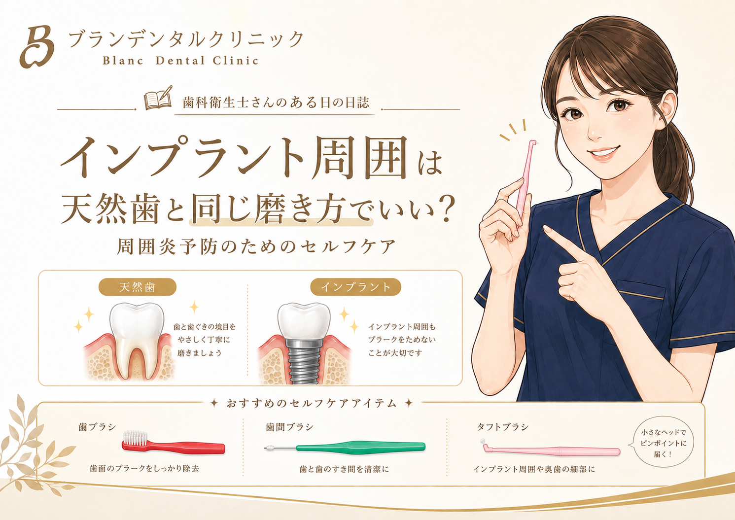 インプラント周囲は天然歯と同じ磨き方でいい？周囲炎予防のためのセルフケアを歯科衛生士が解説
