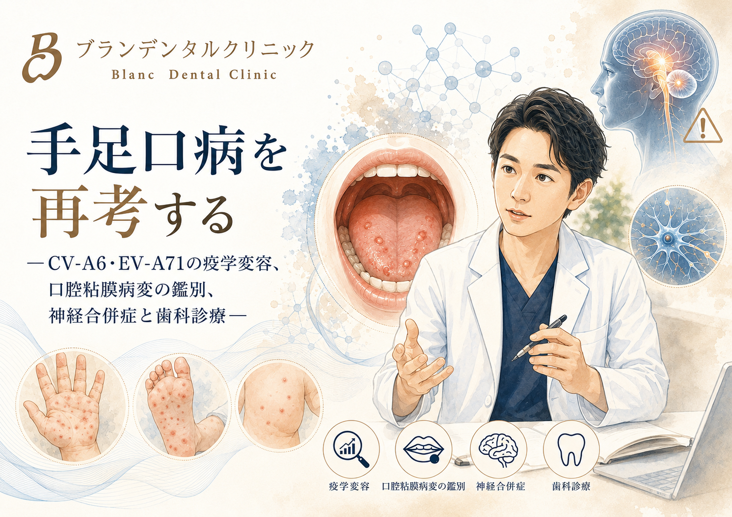 手足口病を再考する:CV-A6・EV-A71の疫学変容、口腔粘膜病変の鑑別、神経合併症と歯科診療