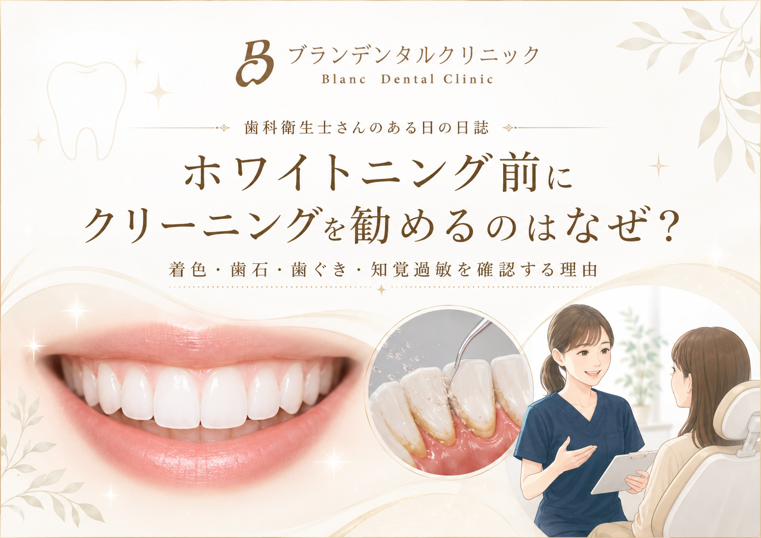 ホワイトニング前にクリーニングを勧めるのはなぜ？着色・歯石・歯ぐき・知覚過敏を確認する理由