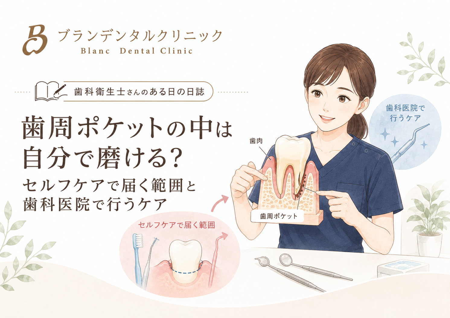 歯周ポケットの中は自分で磨ける？セルフケアで届く範囲と歯科医院で行うケア