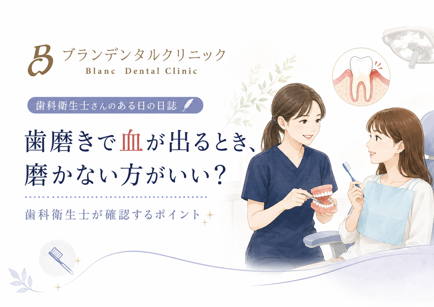 歯磨きで血が出るとき、磨かない方がいい？歯科衛生士が確認する歯ぐきの炎症と磨き方