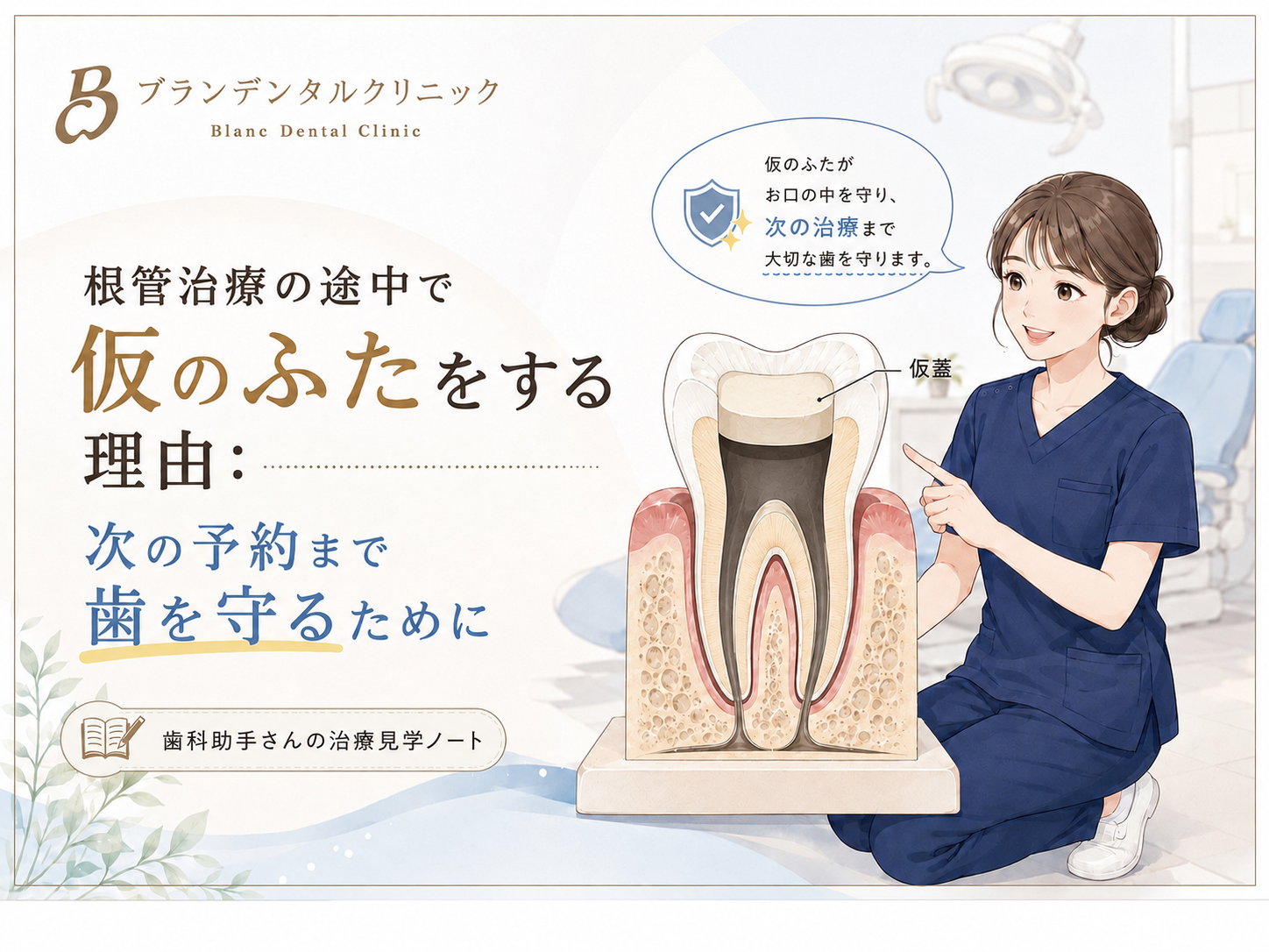 根管治療の途中で仮のふたをする理由：次の予約まで歯を守るために