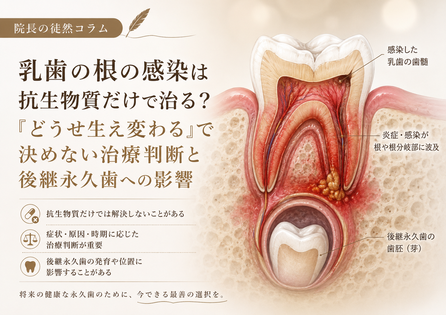 乳歯の根の感染は抗生物質だけで治る？「どうせ生え変わる」で決めない治療判断と後継永久歯への影響