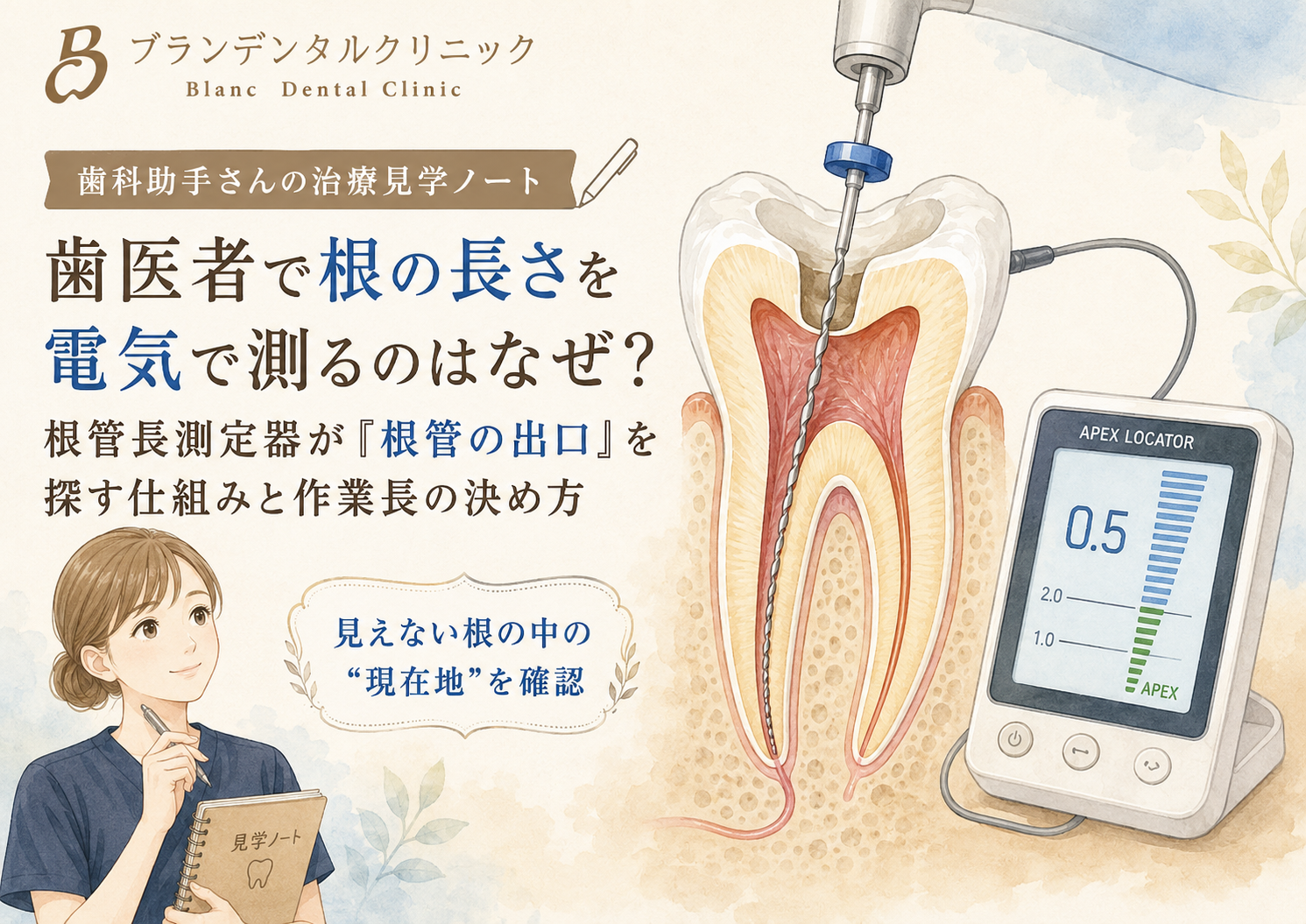 歯医者で根の長さを電気で測るのはなぜ？根管長測定器が「根管の出口」を探す仕組みと作業長の決め方