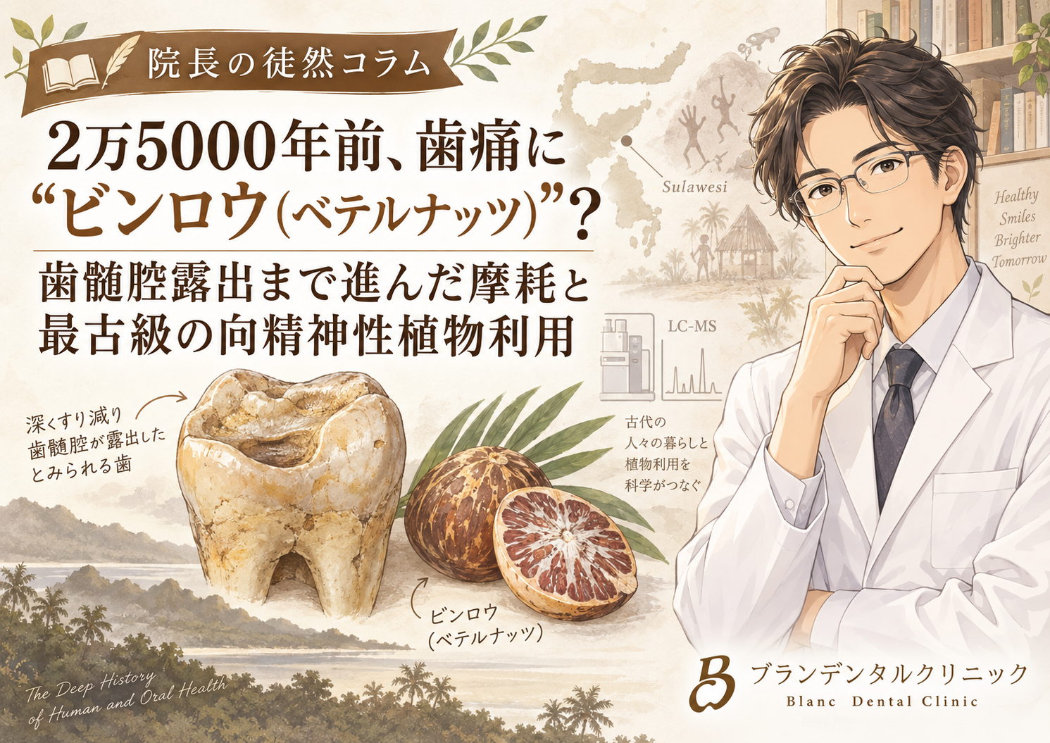 2万5000年前、歯痛に“ビンロウ（ベテルナッツ）”？歯髄腔露出まで進んだ摩耗と最古級の向精神性植物利用
