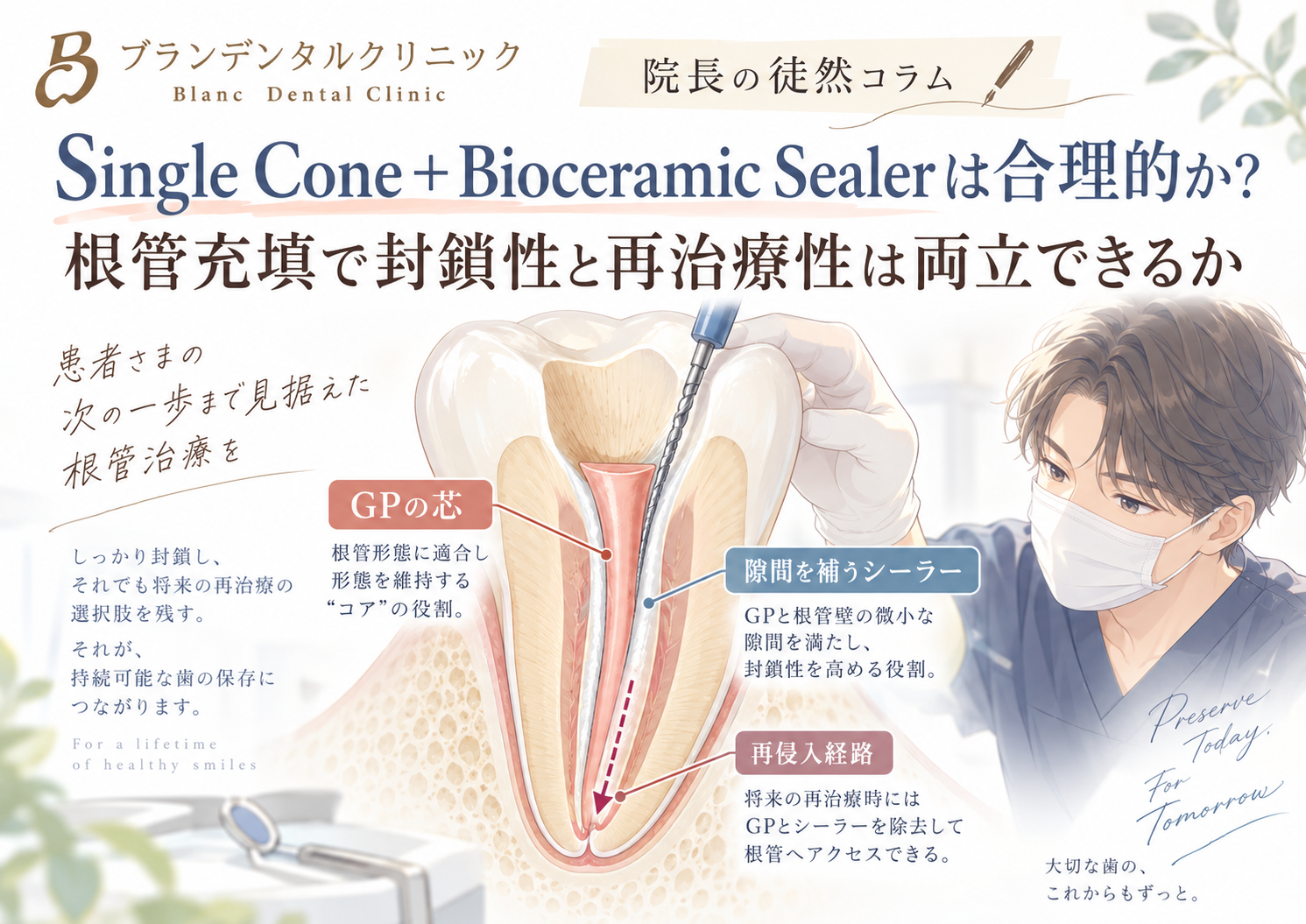Single Cone＋Bioceramic Sealerは合理的か？根管充填で封鎖性と再治療性は両立できるか