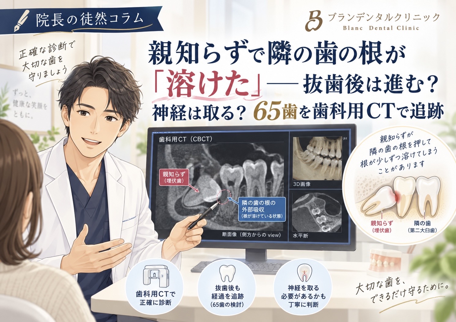 親知らずで隣の歯の根が「溶けた」――抜歯後は進む？神経は取る？65歯を歯科用CTで追跡