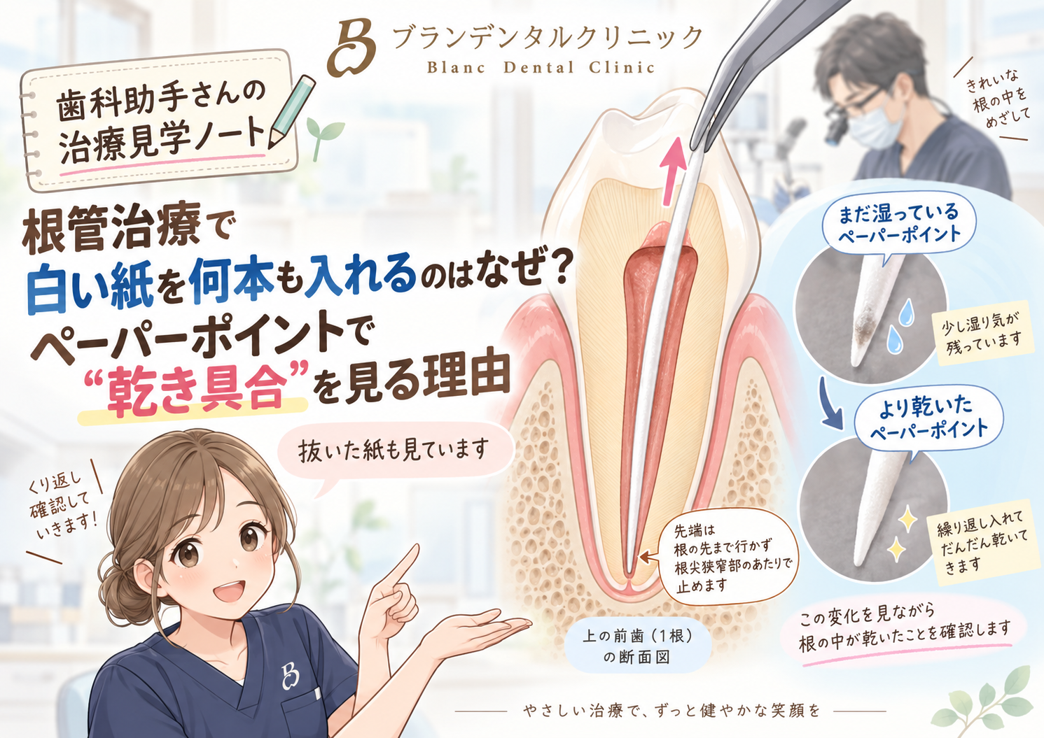 根管治療で白い紙を何本も入れるのはなぜ？ペーパーポイントで“乾き具合”を見る理由