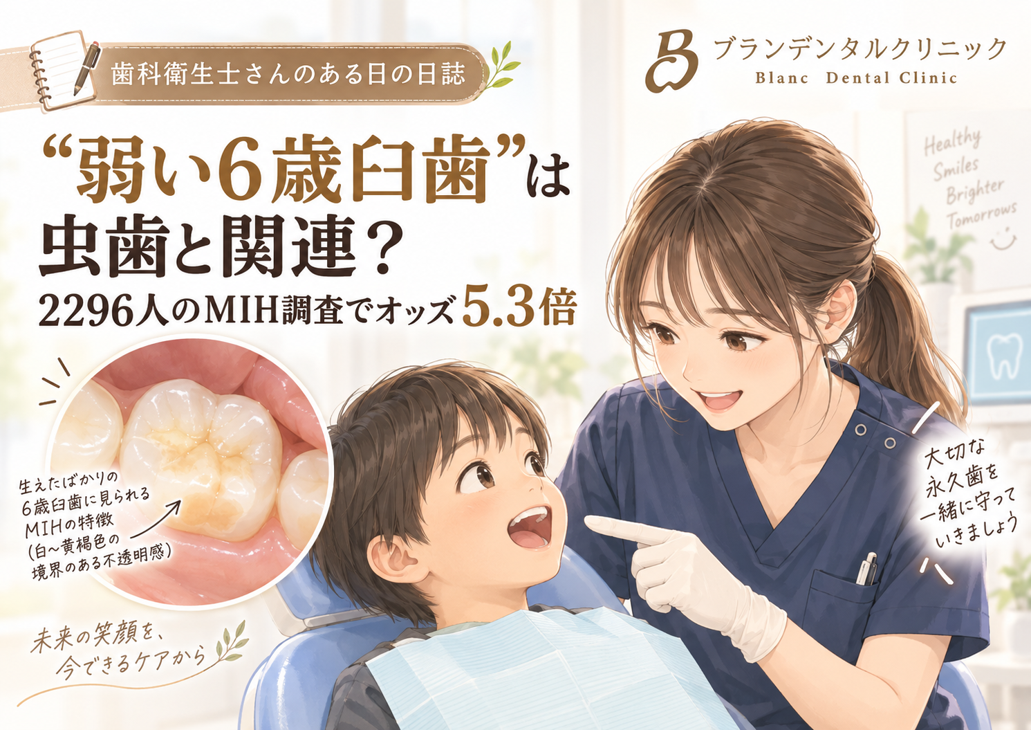 “弱い6歳臼歯”は虫歯と関連？2296人のMIH調査でオッズ5.3倍