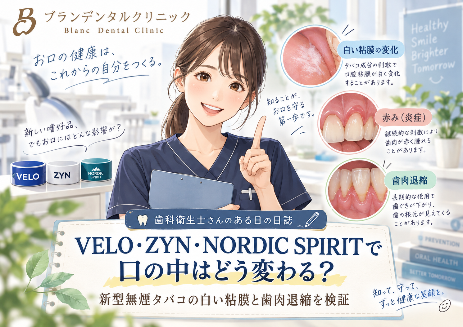VELO・ZYN・NORDIC SPIRITで口の中はどう変わる？新型無煙タバコの白い粘膜と歯肉退縮を検証