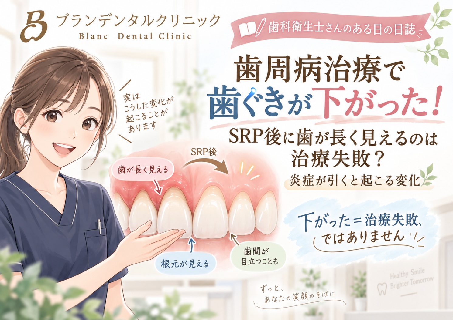 歯周病治療で歯ぐきが下がった！SRP後に歯が長く見えるのは治療失敗？炎症が引くと起こる変化