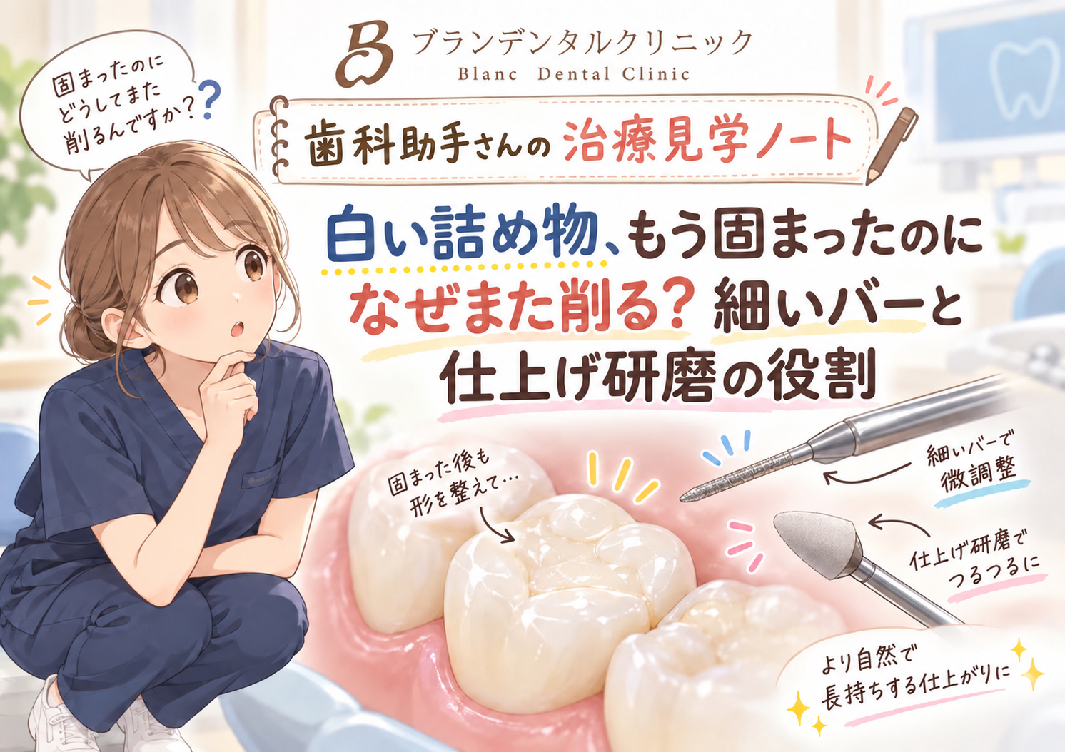 白い詰め物、もう固まったのになぜまた削る？細いバーと仕上げ研磨の役割