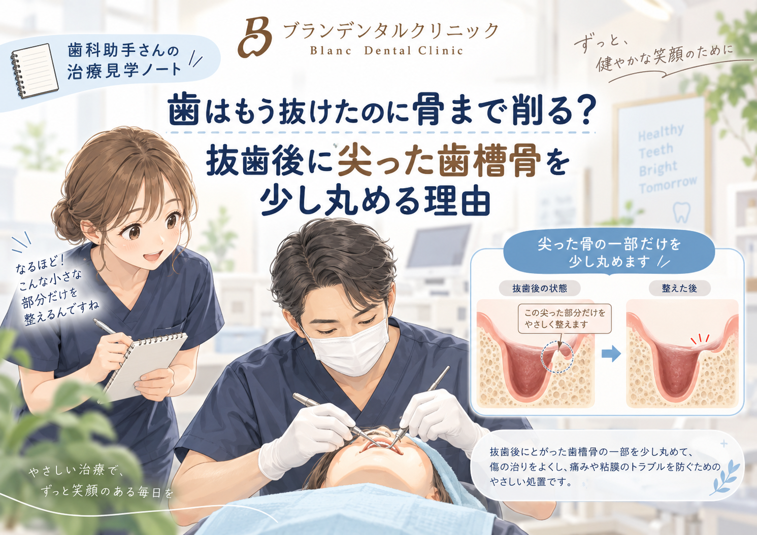 歯はもう抜けたのに骨まで削る？抜歯後に尖った歯槽骨を少し丸める理由