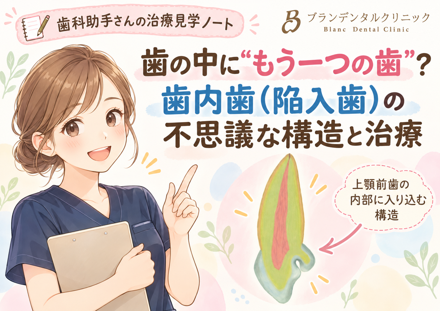 歯の中に“もう一つの歯”？歯内歯（陥入歯）の不思議な構造と治療
