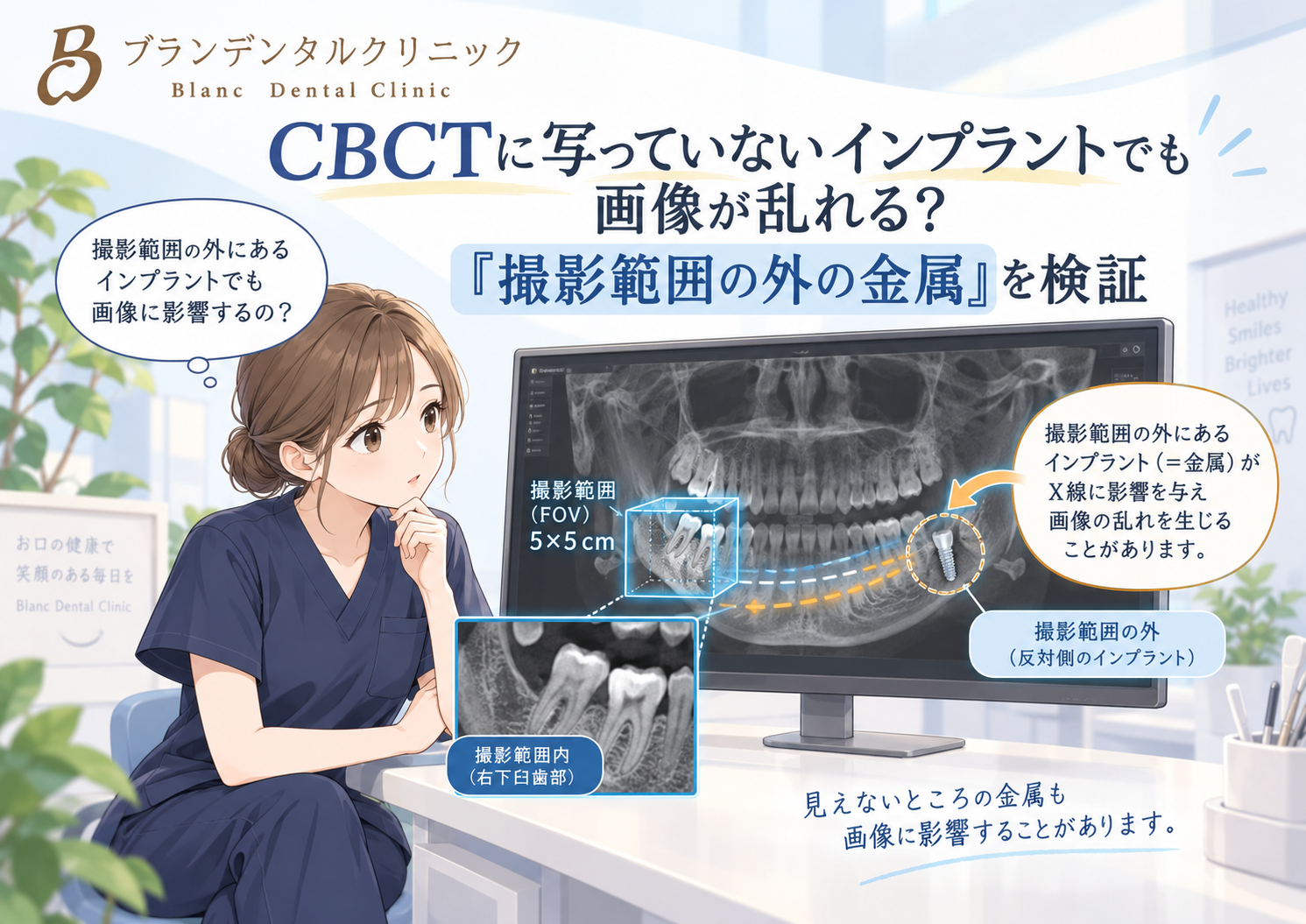 CBCTに写っていないインプラントでも画像が乱れる？「撮影範囲の外の金属」を検証