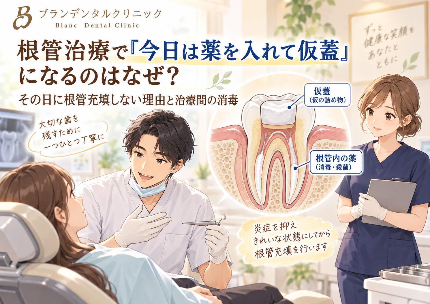根管治療で「今日は薬を入れて仮蓋」になるのはなぜ？その日に根管充填しない理由と治療間の消毒
